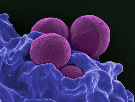 New antibiotic packs a punch against bacterial resistance