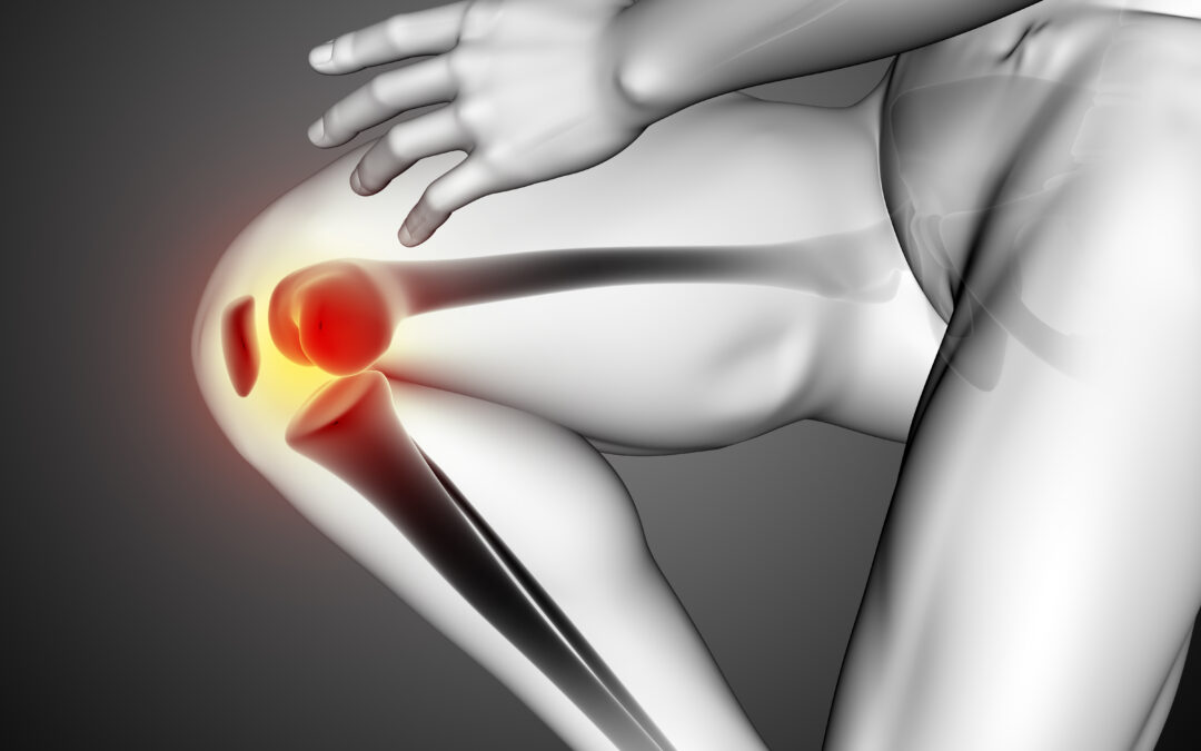 ¿Qué tan efectivo es Synolis VA para acabar con el dolor de rodilla?