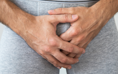Tratamiento de infecciones refractarias de prótesis de pene con perlas de sulfato de calcio