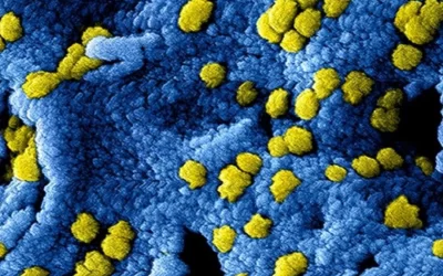GeneX (β-fosfato tricálcico) + antibióticos: ¿Una solución efectiva contra el biofilm de Staphylococcus aureus resistente a la meticilina?