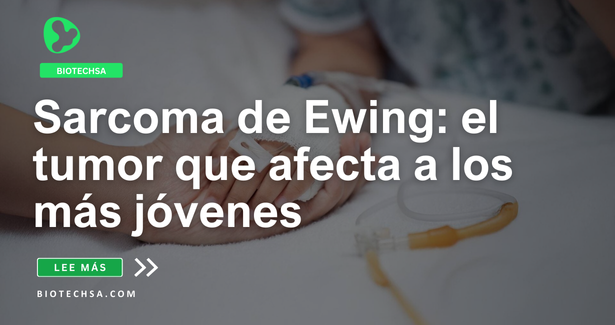 Sarcoma de Ewing: el tumor que afecta a los más jóvenes