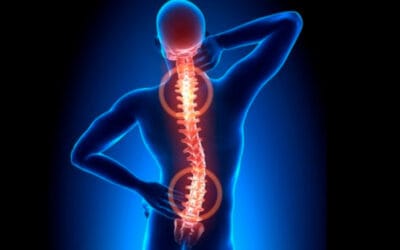 Refuerzo anterior en fracturas toracolumbares: el papel de los injertos óseos compuestos de calcio