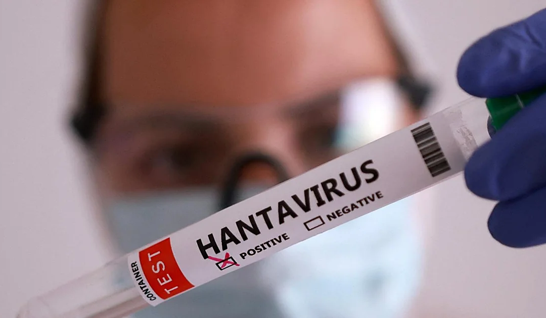 Hantavirus