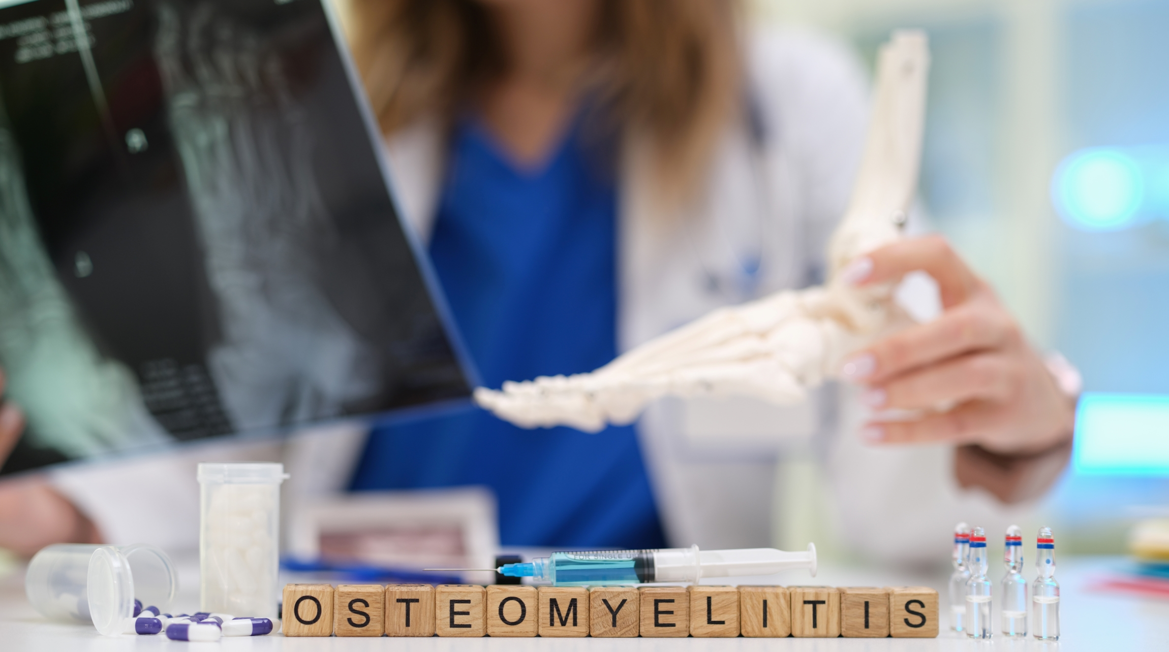 Osteomielitis crónica: uso simultáneo de STIMULAN + aspirado de médula ósea para combatir infecciones complejas