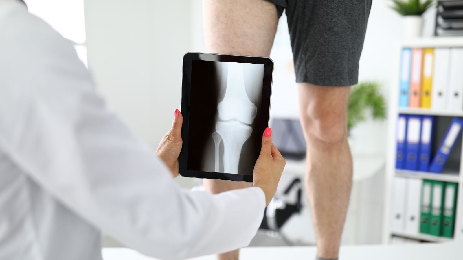 Osteoartrosis de rodilla: estudio identifica las principales vías biológicas detrás de la enfermedad