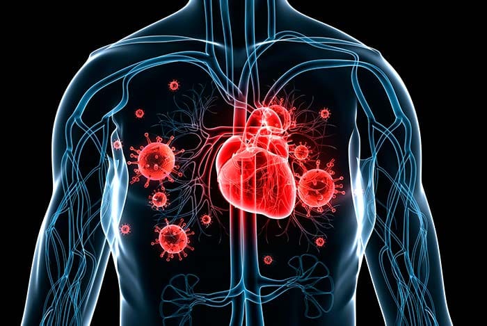 Valor clínico de STIMULAN en endocarditis infecciosa