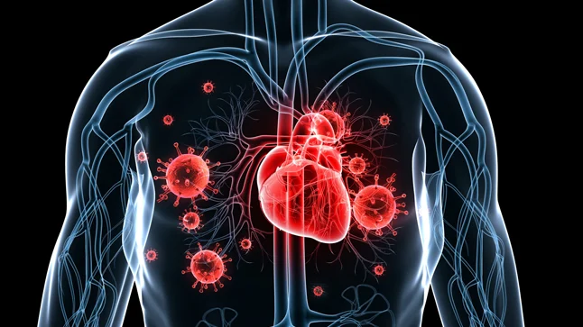 Valor clínico de STIMULAN en endocarditis infecciosa