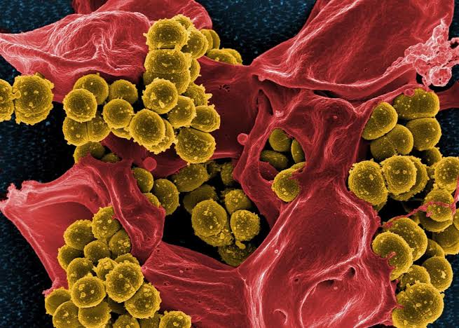 Biofilm por MRSA: eficacia del ß-fosfato tricálcico y sulfato de calcio como sistemas de liberación local de contezolid acefosamil