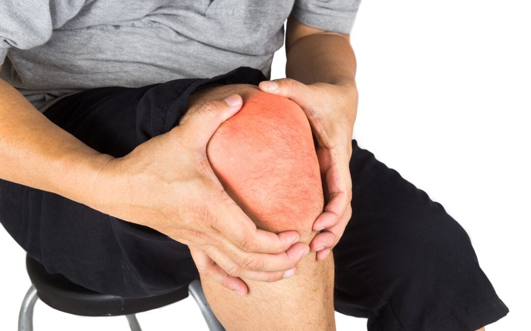 Factores que influyen en la respuesta a Synolis VA en pacientes con OA de rodilla: hallazgos novedosos