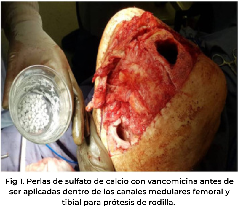 articulares periprotésicas profilaxis
