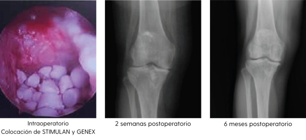 rodilla
